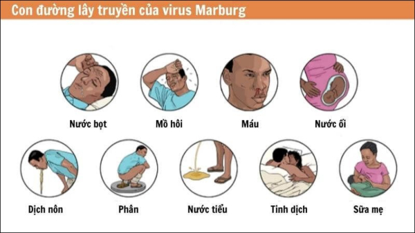 virus Marburg